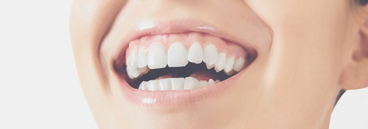 Dent-cassée-Guide-dentaire-Dentego